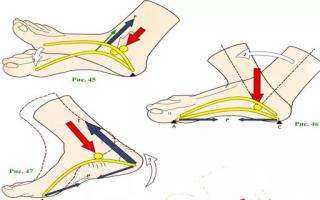 Біль у м'язах ніг - причини, характер, лікування